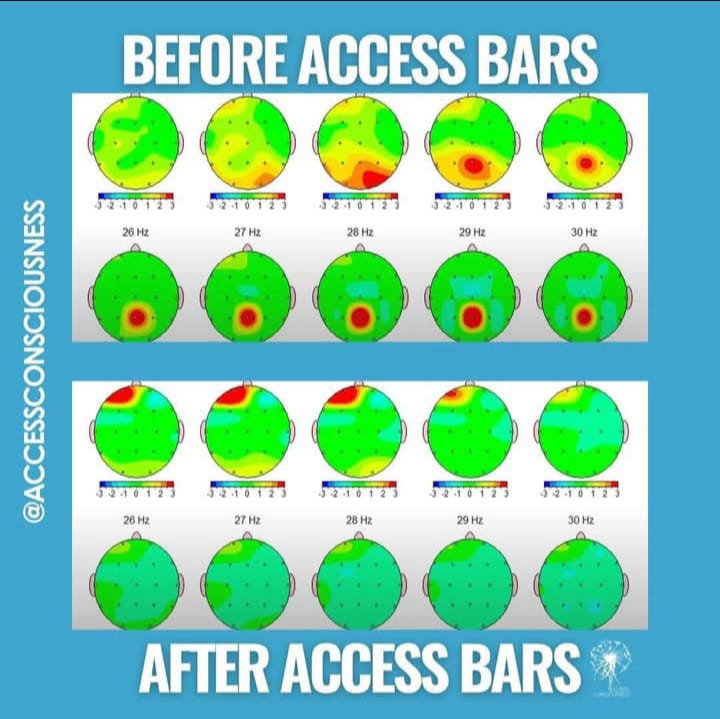 Symbolbild einer Studie, wie sich Access Bars Sitzungen auf ein Gehirn auswirken