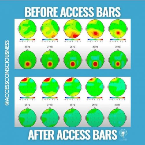 Symbolbild einer Studie, wie sich Access Bars Sitzungen auf ein Gehirn auswirken